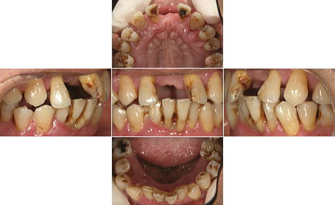 All-on-4�O�̑g�摜