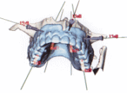 ALL ON 4�E�I�[���I��4