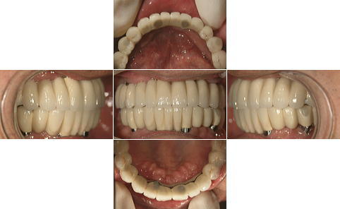 All-on-4��̑g�摜