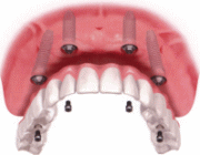 ALL ON 4�E�I�[���I��4