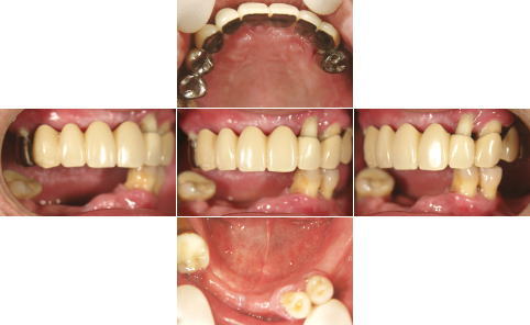 All-on-4�O�̑g�摜