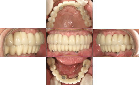 All-on-4��̑g�摜