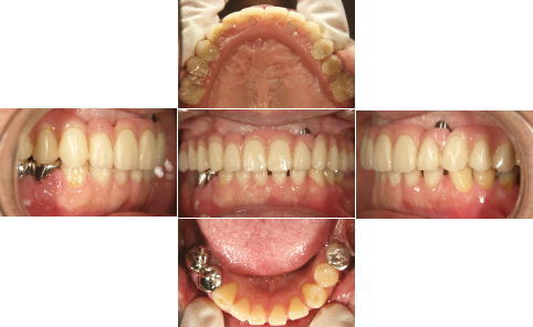 All-on-4��̑g�摜