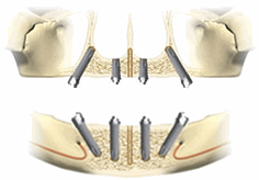 �I�[�����t�H�[