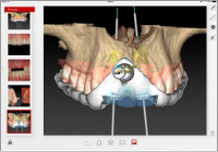 �m�[�x���K�C�h