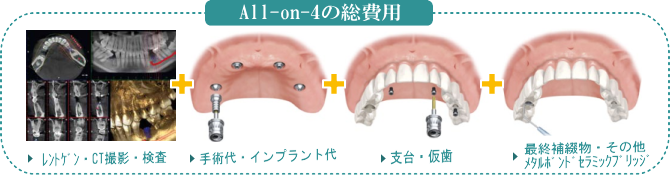 �I�[���I���t�H�[�̑��z�E��p���z